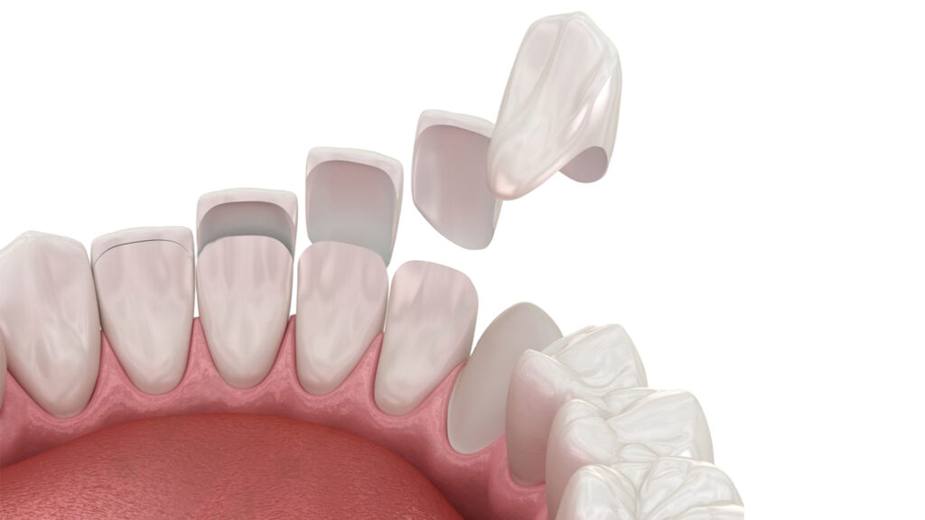 dental
