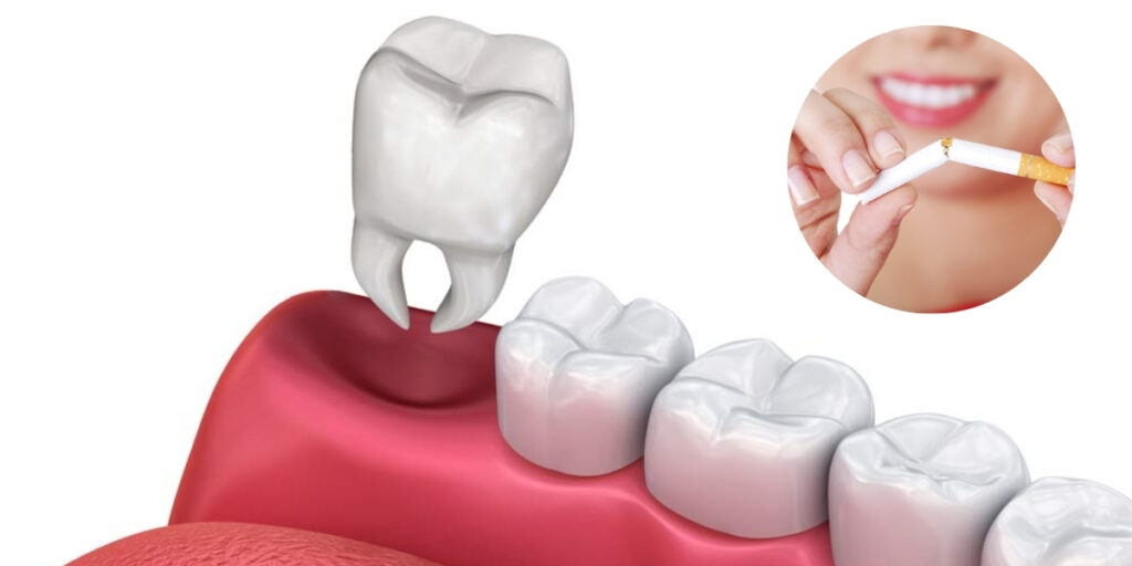 Is It Okay For You To Smoke After Tooth Extraction? - Newton Dental Studio | Livera Dental Clinic