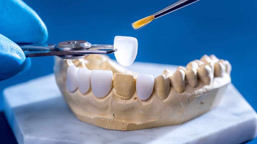 tooth cutting