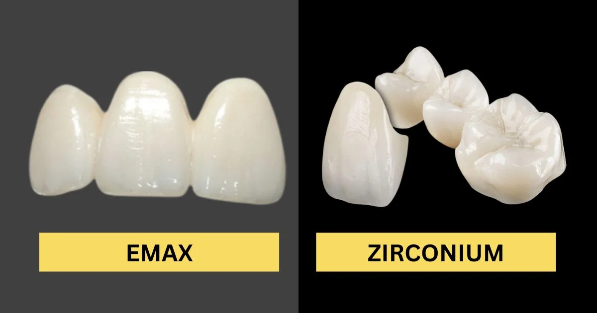 Zirconium Emax Comparison: Which Is Better? What Are the Differences?