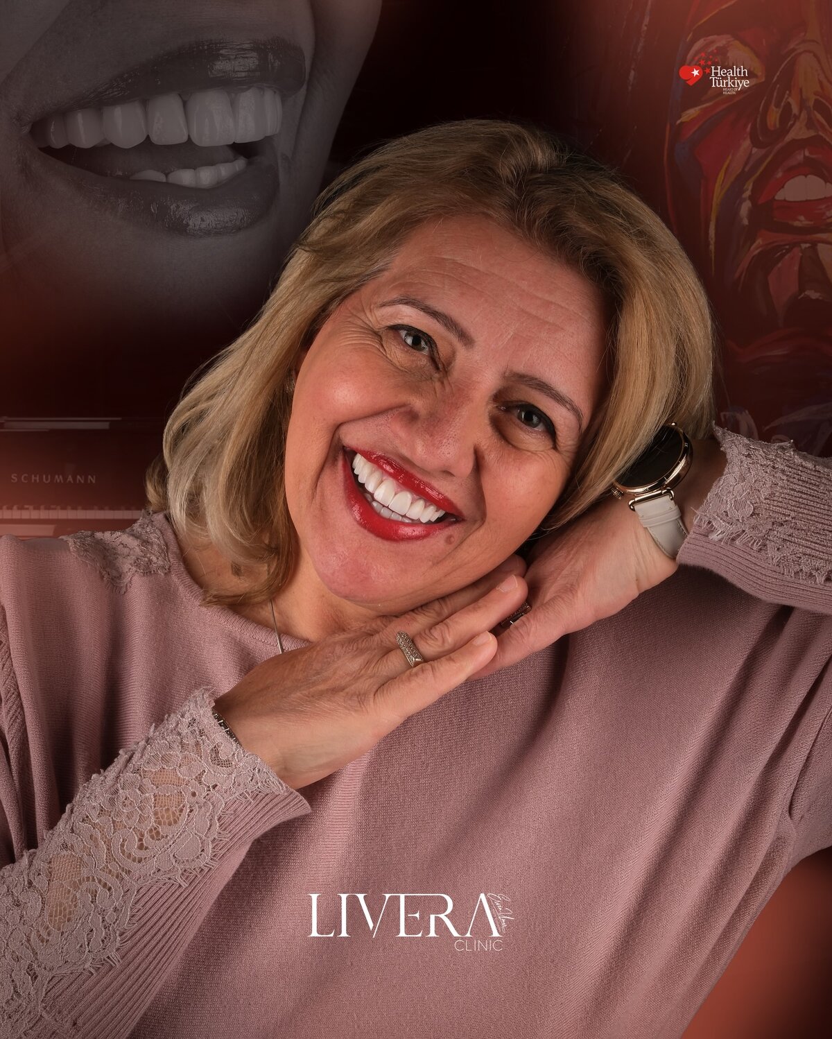 Dental Implants
